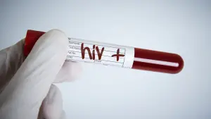 Read more about the article HIV Unraveled: It is not a Death Sentence