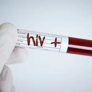 HIV Unraveled: It is not a Death Sentence